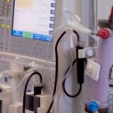 Estudo alerta para subdiagnóstico da doença renal crônica no Brasil