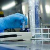 Exame auxilia diagnóstico de meningite bacteriana na rede pública