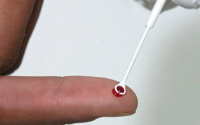 Fiji declara emergência nacional por HIV com 1 caso a cada 60 pessoas