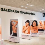 Exposição fotográfica “Cicatrizes” alerta sobre o câncer de mama