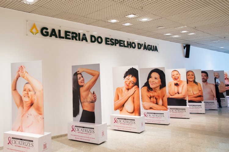 Exposição fotográfica “Cicatrizes” alerta sobre o câncer de mama