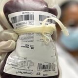 Saúde aprova protocolo para tratar crianças com hemofilia A